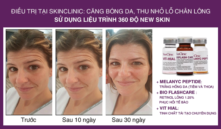 SkinClinic Melanyc Peptide - thần dược cho làn da bị nám