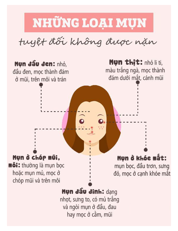 Những loại mụn tuyệt đối không được nặn