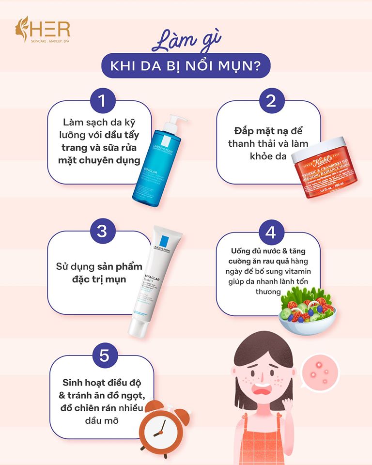 Làm gì khi da bị mụn? Cách trị mụn hiệu quả