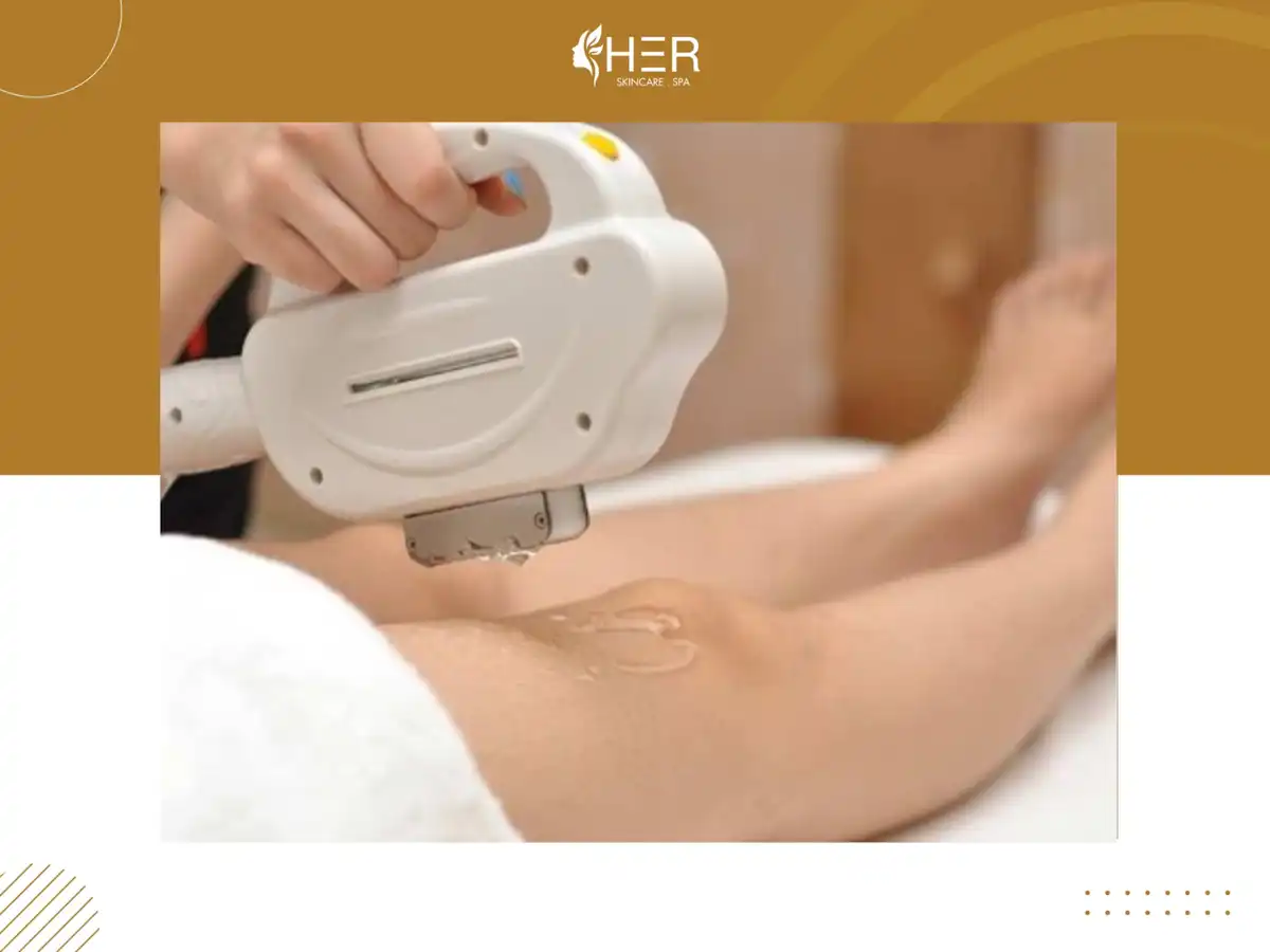 Quy trình triệt lông chân bằng công nghệ Diode Laser