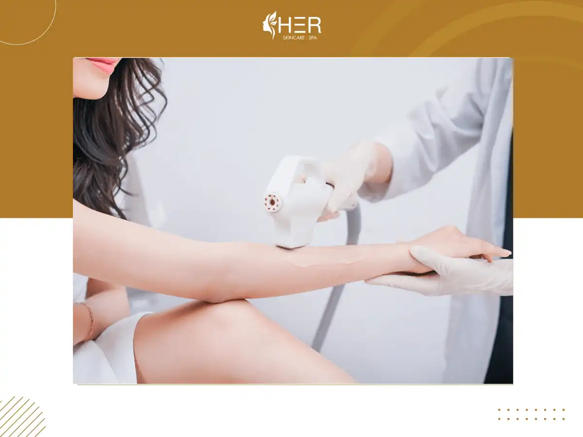 Công nghệ triệt lông hiện đại - Diode Laser