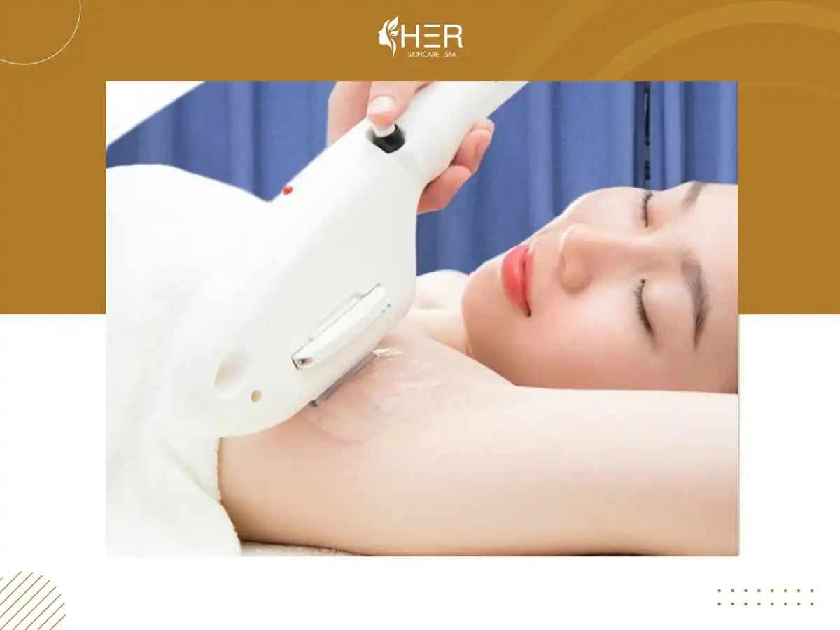 Quy trình triệt lông bằng công nghệ Diode Laser tại HER Spa