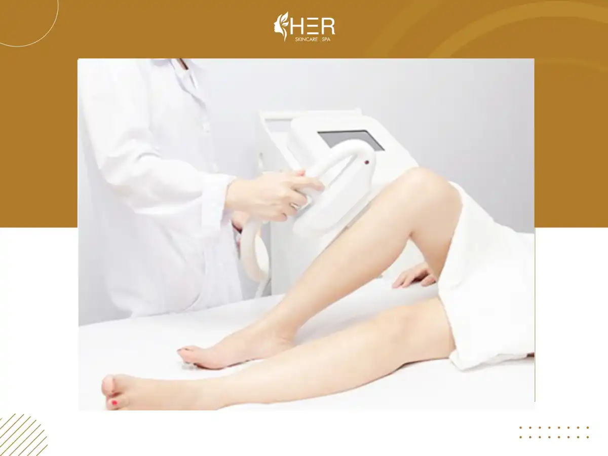 Triệt lông chân vĩnh viễn bằng công nghệ Diode Laser