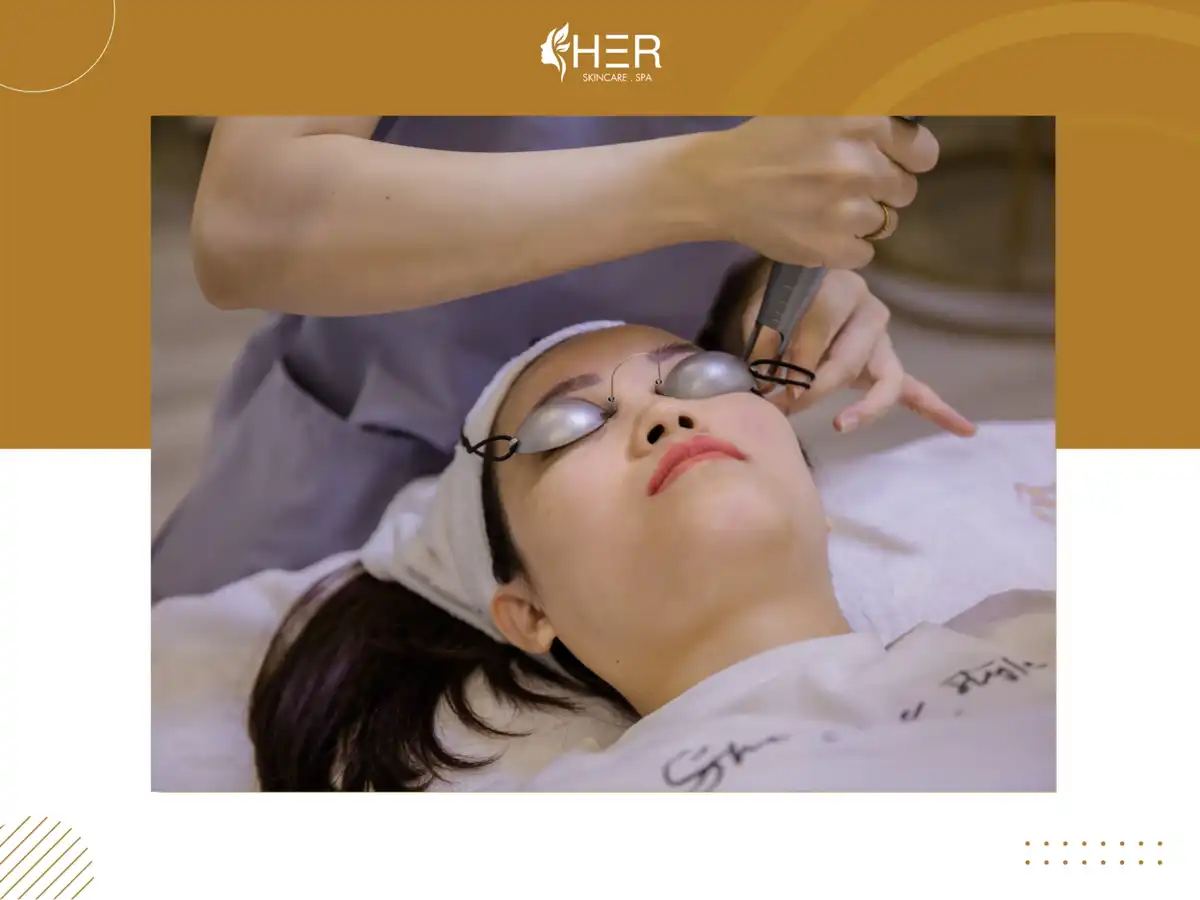 Trị mụn bằng phương pháp bắn tia laser