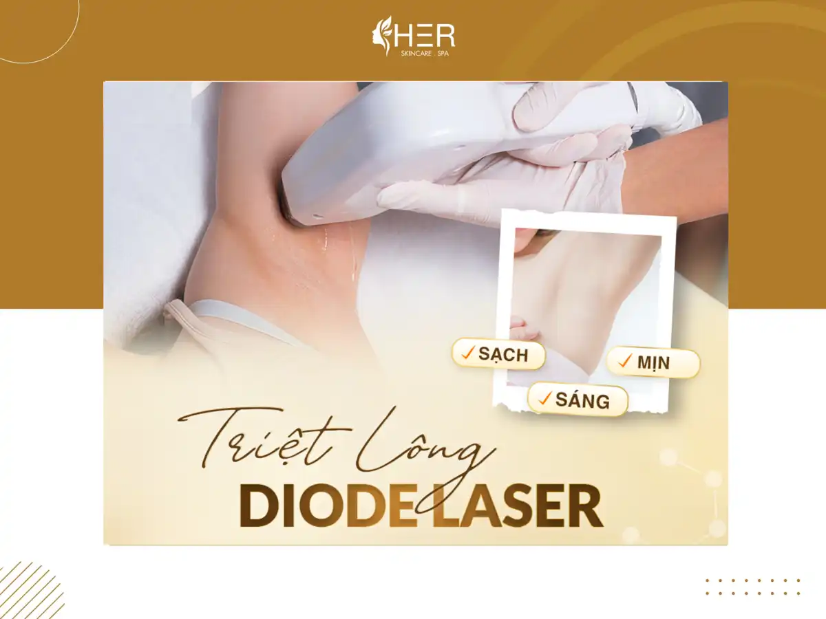 Công nghệ Laser Diode triệt lông vĩnh viễn có hết không?