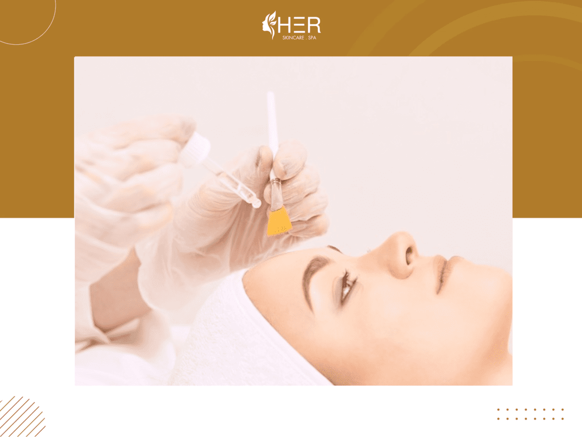 Peeling trị thâm hiệu quả