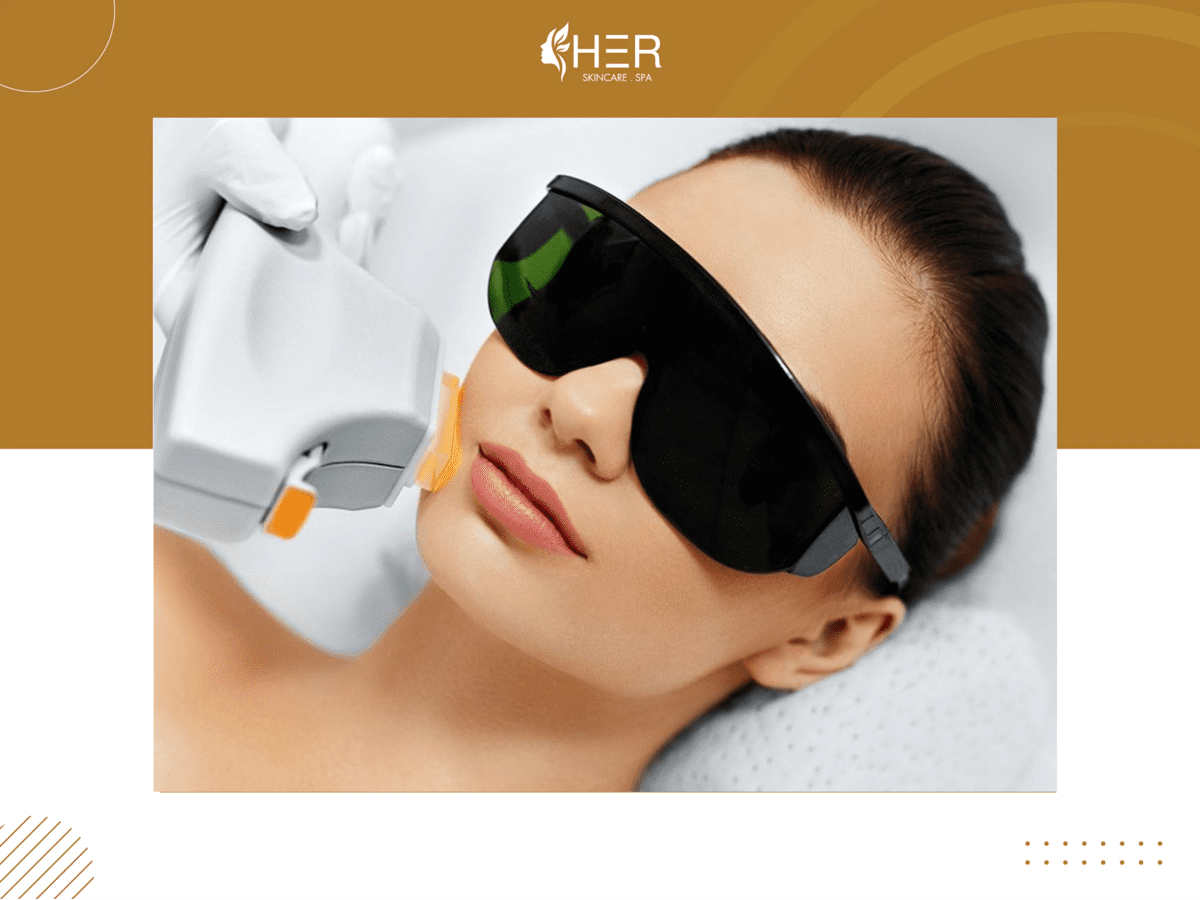 Công nghệ trị thâm mụn Laser IPL