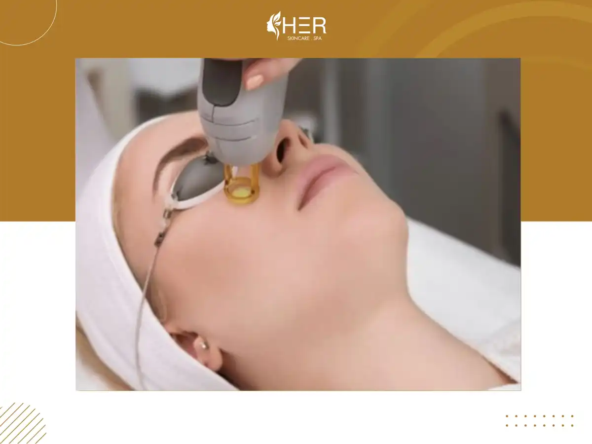 Công nghệ laser vi điểm xóa mờ sẹo