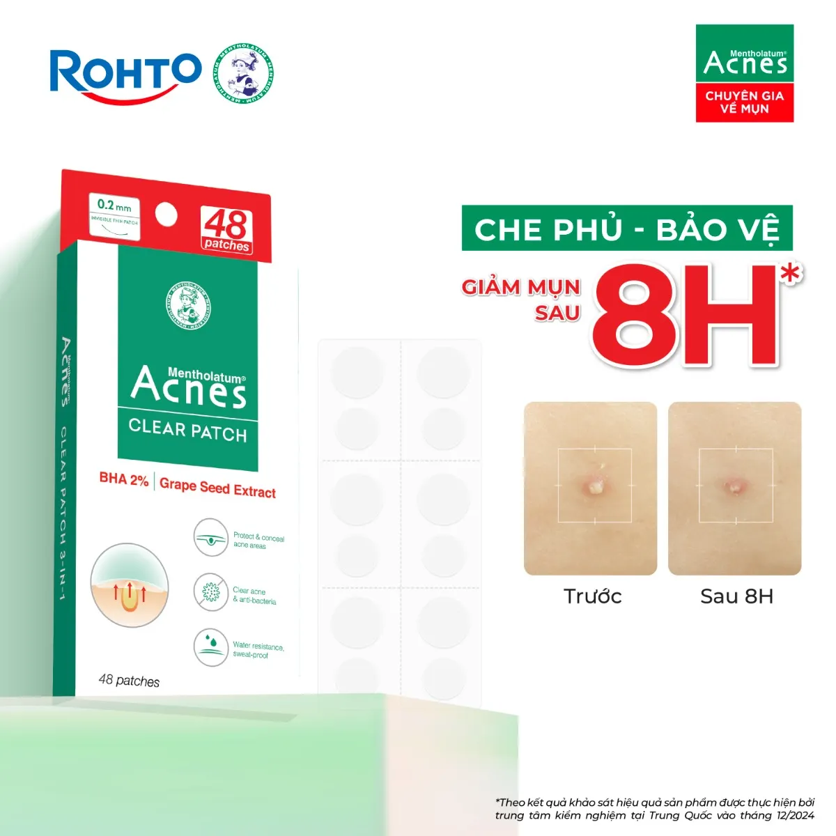 Miếng dán mụn giúp giảm mụn sưng viêm Acnes Clear Patch (48 Miếng).webp