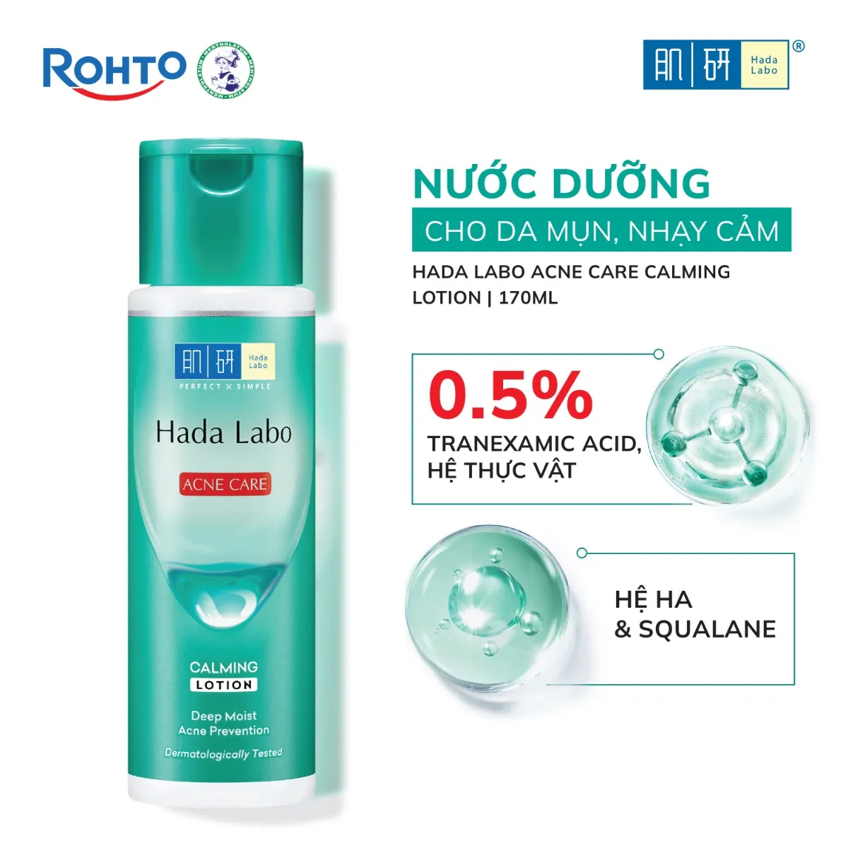 Nước dưỡng ẩm Hada Labo Acne Care Calming Lotion dành cho da dầu mụn, da nhạy cảm 170ml.webp