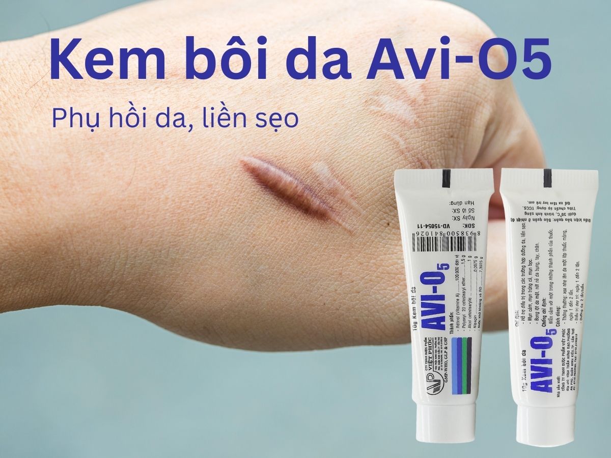 Kem-Mun-Lien-seo-AVI-O5.webp
