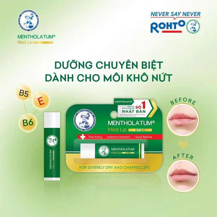 Sap-Duong-Moi-ROHTO-Medi-Lip-Balm-Son-duong-4-3g.webp
