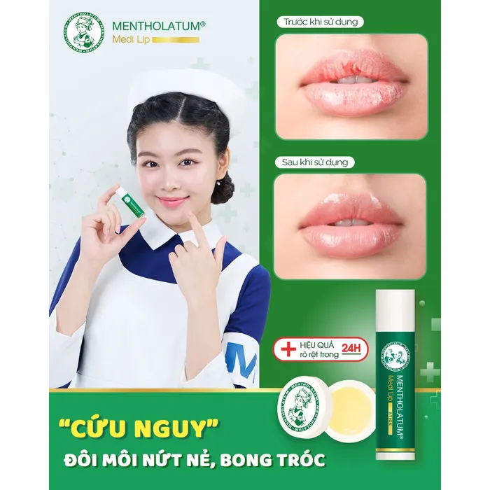 Son dưỡng - Medi Lip Stick.jpg