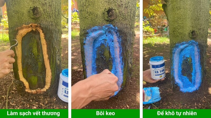 Hướng dẫn bôi keo liền sẹo LS100