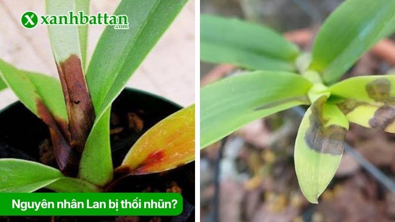 Nguyên nhân Lan bị thối nhũn?