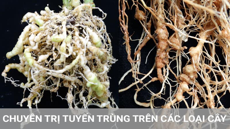 tervigo-dac-tri-tuyen-trung-re-sung-re