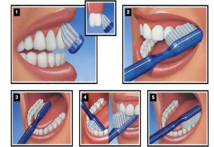 chăm sóc răng miệng đúng cách