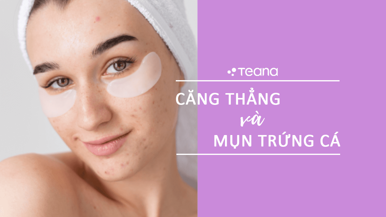 CĂNG THẲNG VÀ MỤN TRỨNG CÁ 