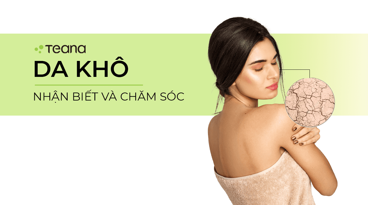 DA KHÔ - NHẬN BIẾT VÀ CÁCH CHĂM SÓC 