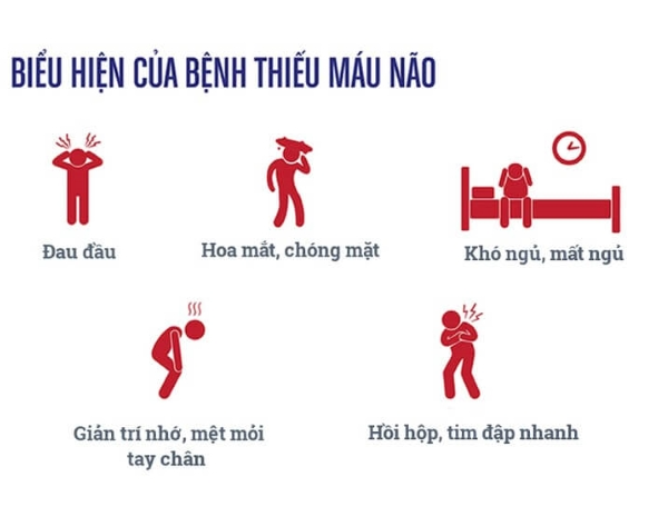 Một số biểu hiện thường thấy khi thiếu máu lên não