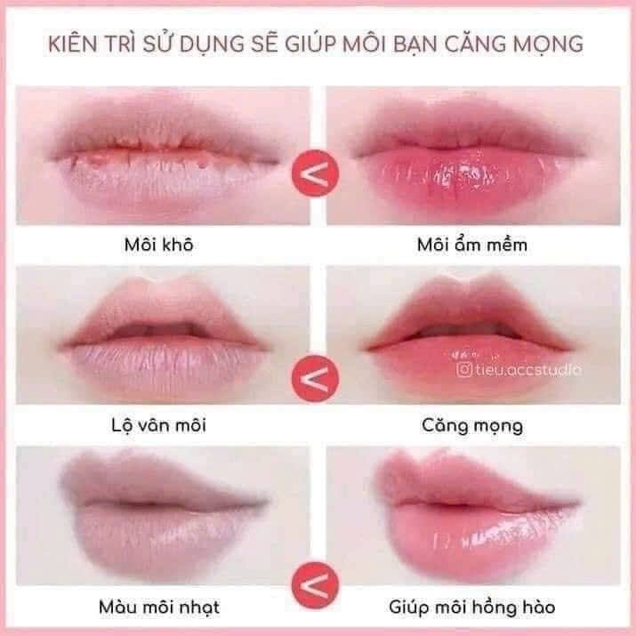 Hũ Dưỡng Môi Vaseline