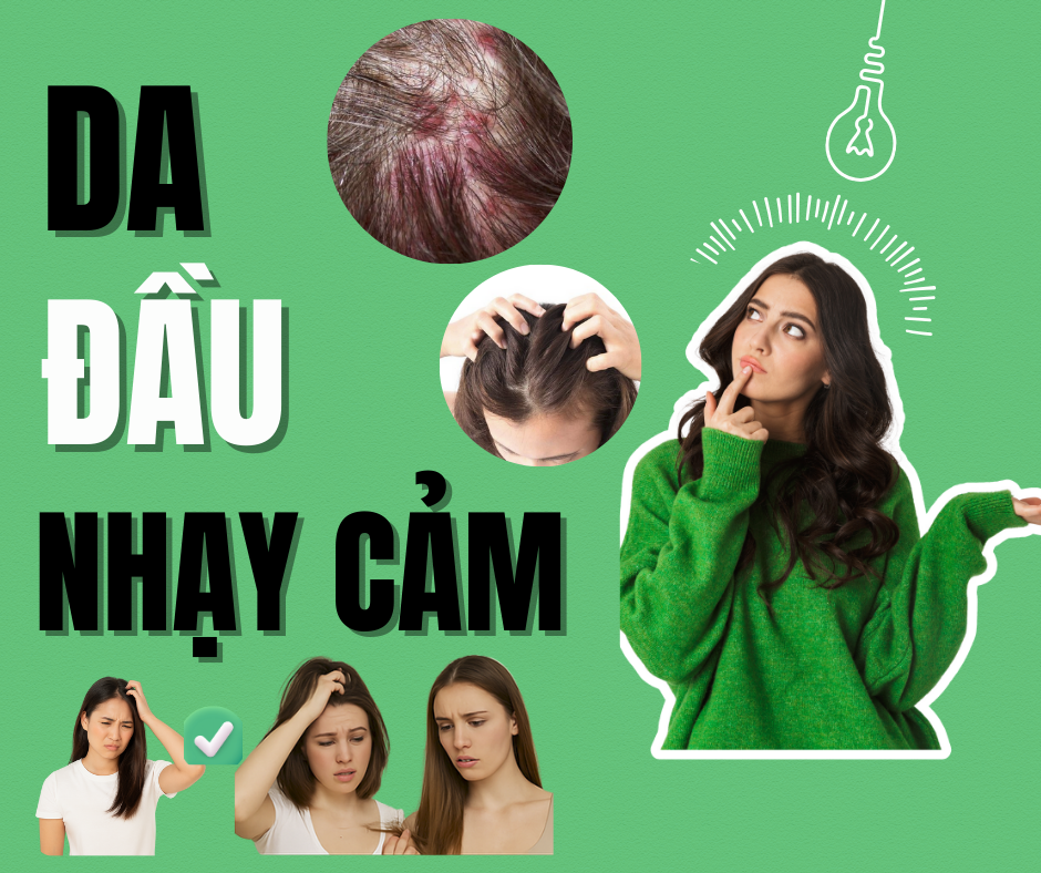 Ngua-rat-bong-troc-Co-the-ban-dang-co-da-dau-nhay-cam-ma-khong-biet--1.png