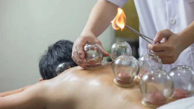 Địa chỉ cạo gió giác hơi nam uy tín, giá cả phải chăng