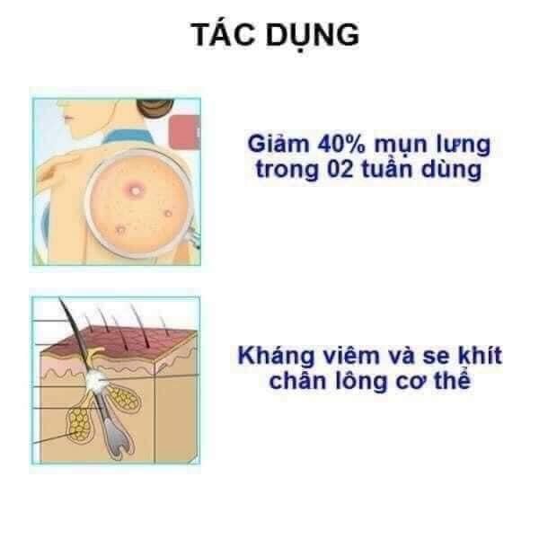 Sữa tắm trị mụn lưng