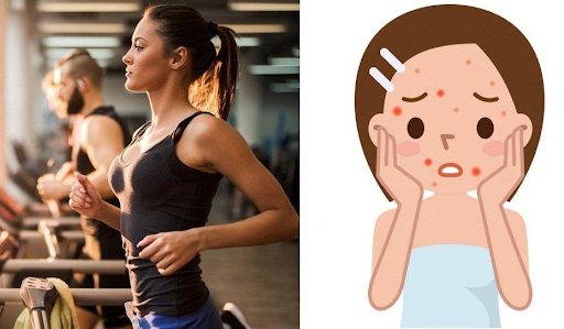 Tập thể dục ra mồ hôi có giảm mụn không?