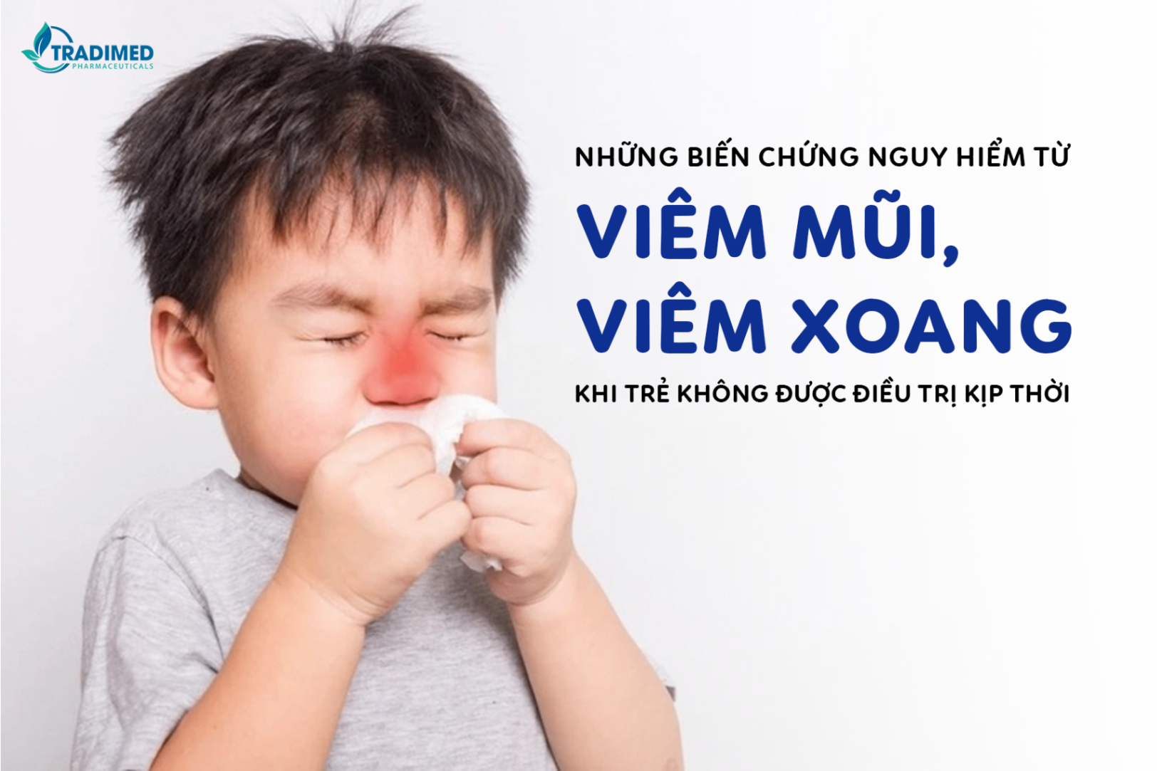 Làm ngay việc này để ngăn ngừa những biến chứng nguy hiểm khi bé bị viêm mũi, viêm xoang