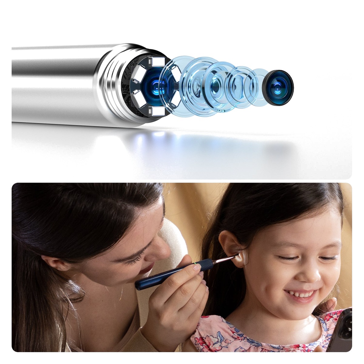 Máy Lấy Ráy Tai Camera Nội Soi 10MP Tích Hợp Nhíp Gắp Cơ Học Bebird EarSight Note 5 | Hàng sắp về - Nhận đặt trước