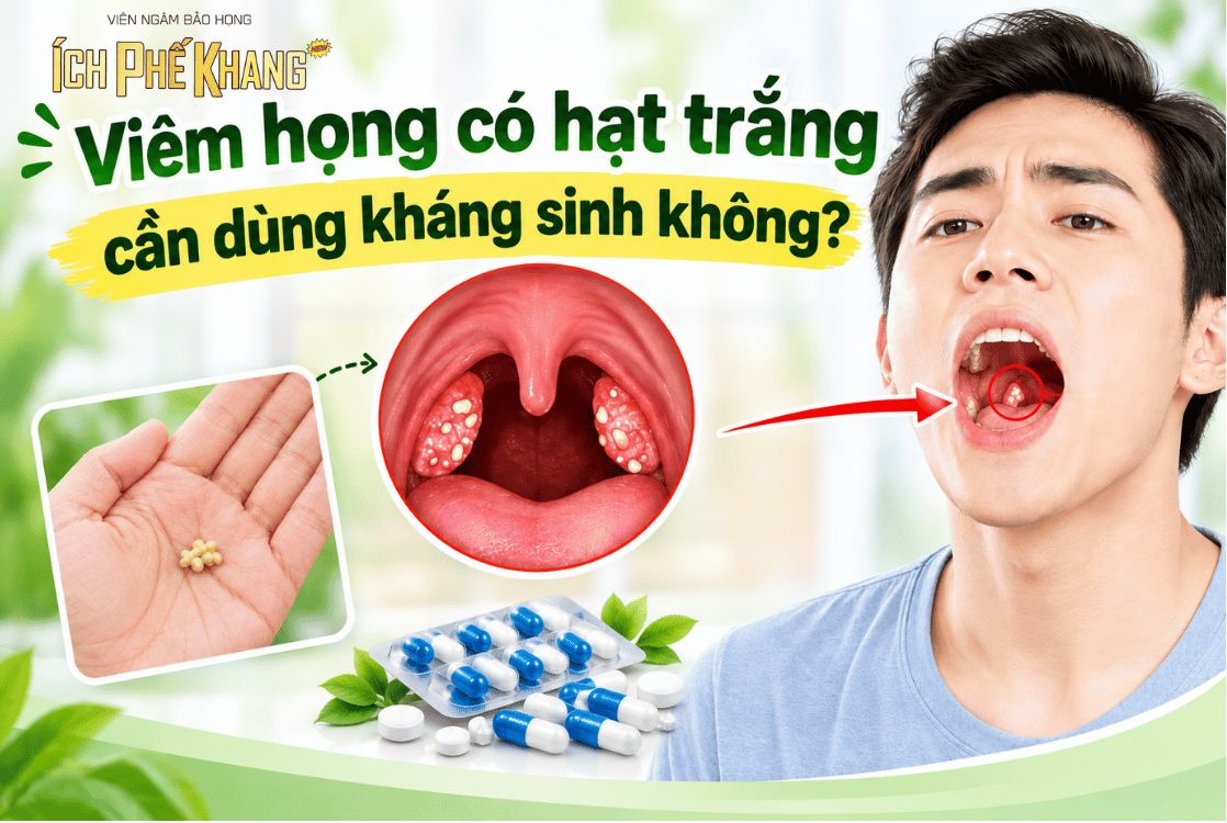 Viêm họng có hạt trắng cần dùng kháng sinh không?