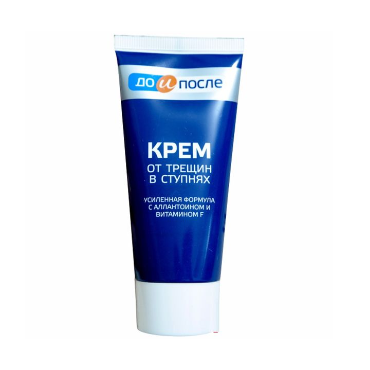 Kem làm giảm nứt nẻ gót chân KPEM 50ml hàng nội địa Nga mềm da dưỡng da mềm mịn