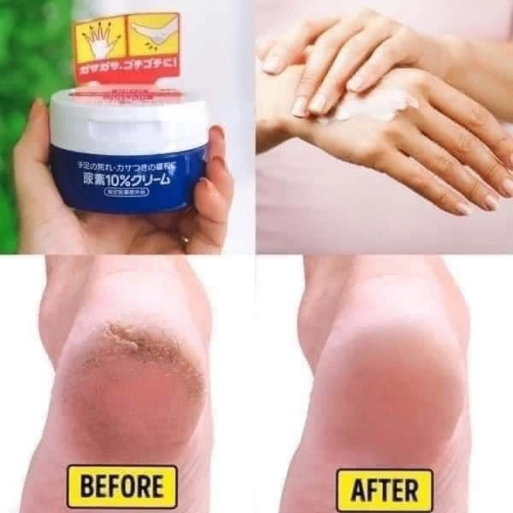 Kem dưỡng tay chân Shiseido Urea Cream 10% 100g