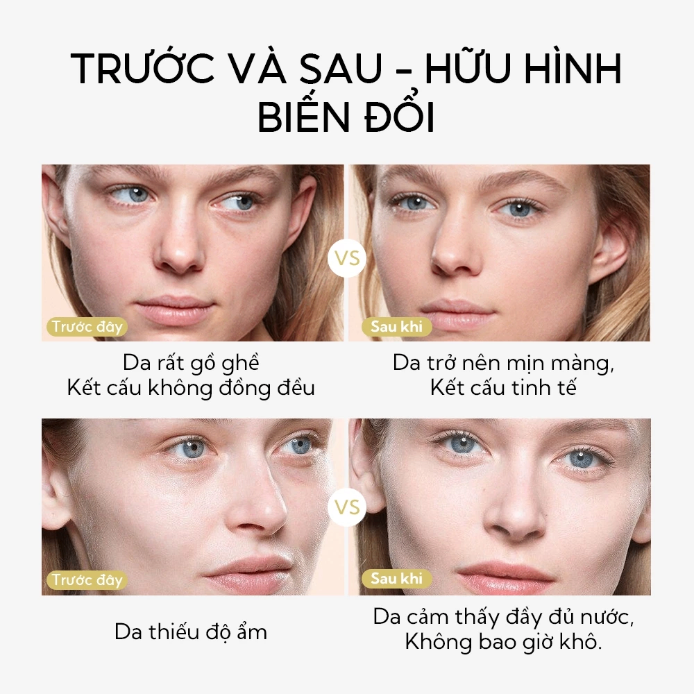 Tẩy tế bào chết dạng xịt Lanbena Exfoliating Peel Spray 3x 30ml