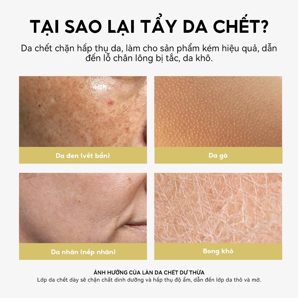 Tẩy tế bào chết dạng xịt Lanbena Exfoliating Peel Spray 3x 30ml