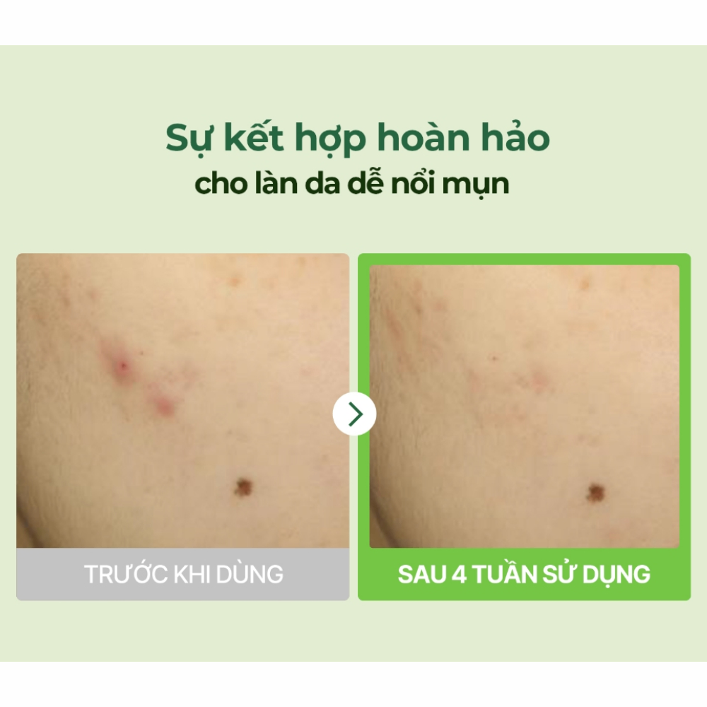 Kem dưỡng Torriden Balanceful Cica Cream 80ml