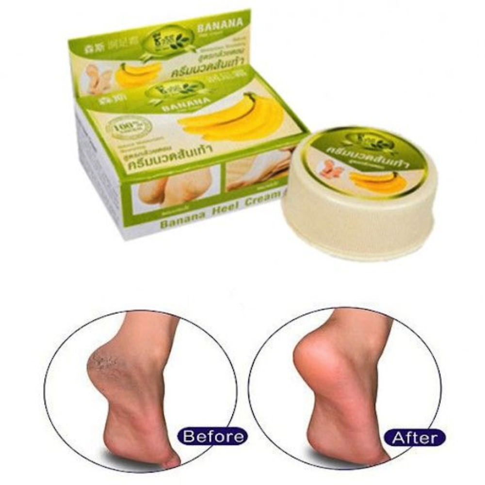Kem giảm nứt gót chân The Banana Cream Heel 30g làm mềm mại hồng gót chân