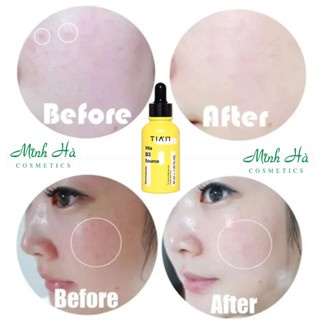 Serum dưỡng trắng Tiam Vita B3 Source 40ml phục hồi làm đều màu da