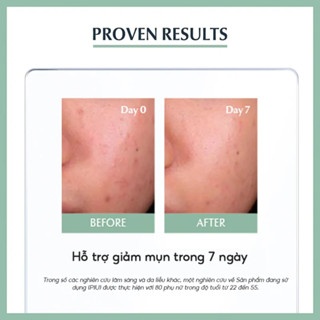 Tinh chất Eucerin Pro Acne SOS Serum 10ml kiểm soát dầu nhờn hỗ trợ giảm mụn