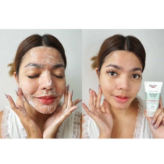 Gel rửa mặt Eucerin Pro Acne Solution 3X Treatment Gel To Foam Cleanser 75ml hỗ trợ giảm mụn mờ thâm