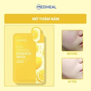 Mặt nạ giấy Mediheal Mask Science 20ml giúp dưỡng ẩm chuyên sâu, sáng da