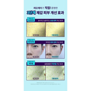 Set huyết thanh Dr.G Blemish Bakuchiol Pore Jet Serum 30ml + 30ml Refill + 1kem 10ml (Màu tím) chăm sóc da toàn diện