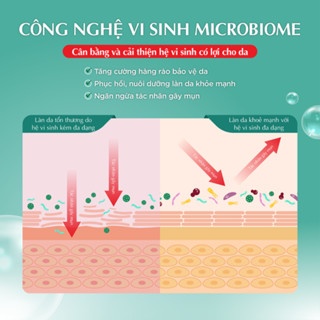 Kem dưỡng ẩm Hada Labo Acne Care Calming Gel Cream 50g cho da mụn, nhạy cảm
