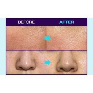 Set huyết thanh Dr.G Blemish Bakuchiol Pore Jet Serum 30ml + 30ml Refill + 1kem 10ml (Màu tím) chăm sóc da toàn diện