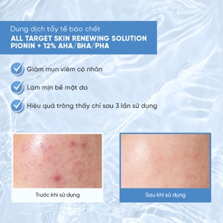 Dung dịch tẩy da chết Emmie All Target Skin Renewing Solution Pionin + 12% AHA/BHA/PHA 120ml làm sạch da hiệu quả