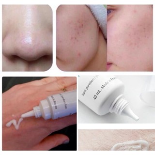 Kem giảm mụn La Roche-Posay Effaclar Duo+ 15/40ml giúp giảm vết thâm và mụn tái phát