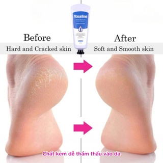 Kem dưỡng da tay và chân Vaseline Deep Moisture Cream 60ml dưỡng ẩm giúp da mềm mại
