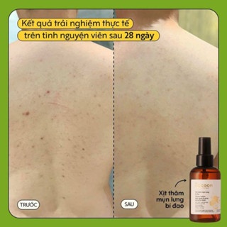 Xịt thâm mụn lưng bí đao Cocoon 140ml thuần chay làm sạch mụn, làm mờ vết thâm