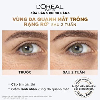 Serum dưỡng da vùng mắt Loreal Revitalift 2.5% Hyaluronic Acid + Caffeine Eye Serum 20ml giảm bọng mắt mờ quầng thâm